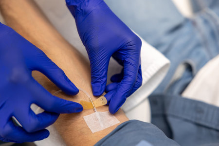 Inserting catheter into vein in patients arm in hospital medicinal solution intravenously.の写真素材