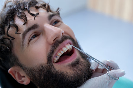 Dentist performing examination with specialized tools during routine dental checkupの写真素材