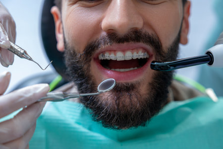 Orthodontic specialist using professional instruments to inspect teeth for caries and provide careの写真素材