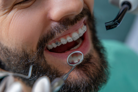 Doctor in clinic conducting detailed tooth inspectionの写真素材