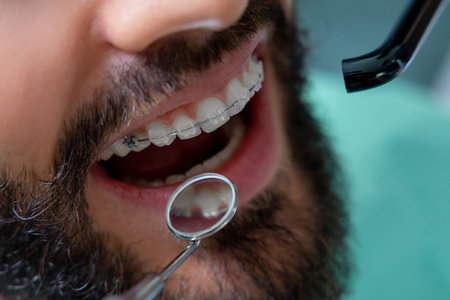 Doctor in clinic conducting detailed tooth inspectionの写真素材