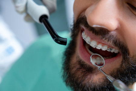 Professional mouth examination and dental treatment checkup in clinicの写真素材