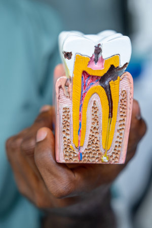 Orthodontic model used in dental education, showing the human tooth anatomyの写真素材