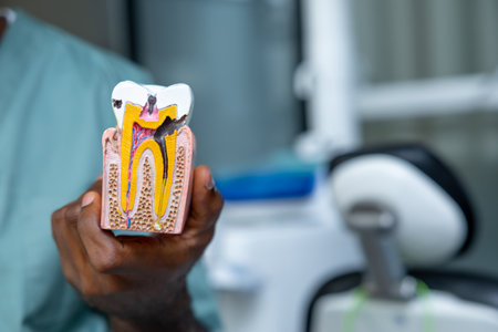 Doctor discussing dental care and tooth decay prevention, focusing on cariesの写真素材