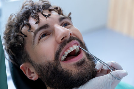 Bearded man patient during treatment procedure with dental tools in dentist officeの写真素材