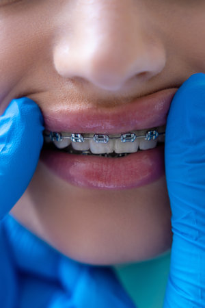 Unrecognizable woman having examination at dental office w