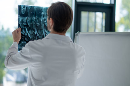 Physician in lab coat analyzing transparent MRI filmの写真素材
