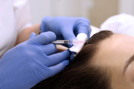 Doctor makes a shot in the scalp, mesotherapy for hairの写真素材
