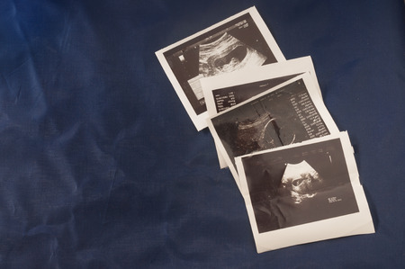 ultrasound scan pictureの写真素材