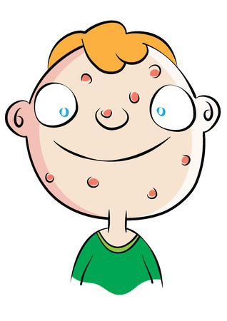 Cute white boy with acne problem vector illustration.のイラスト素材