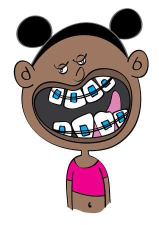 funny black girl with dental braces cartoon vector illustrationのイラスト素材