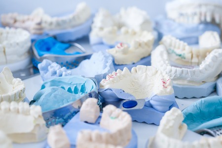 Denture and implant production: variety of dental plaster moulds and imprints with metal stock traysの写真素材