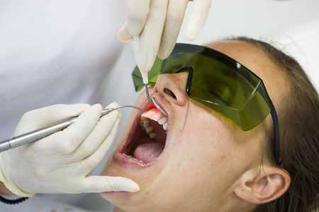 Dentist using a modern diode dental laser for periodontal care. Patient wearing protective glasses, preventing eyesight damage. Periodontitis, dental hygiene, preventive procedures concept.Êの写真素材
