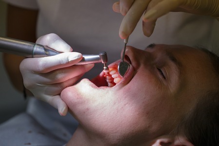 Patient at dental hygienists office, getting teeth cleaned and polished with prophylactic paste, preventing caries and periodontal disease. Dental hygiene, dental procedures and prevention concept.の写真素材
