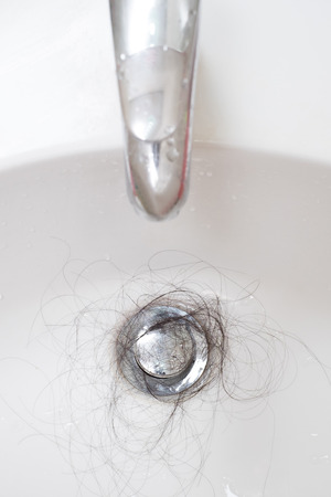 Hair loss problem in white sink.の写真素材