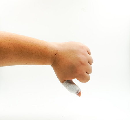 splint finger a broken bone hand Injuredの写真素材