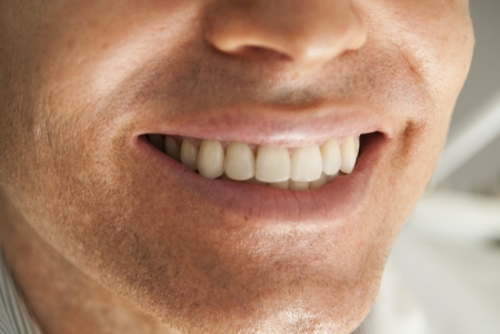 Male dental patient showing teeth