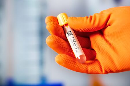 Hand holds test tube for Coronavirus 2019-nCOV analysis