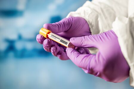 Hand holds test tube for Coronavirus 2019-nCOV analysisの写真素材