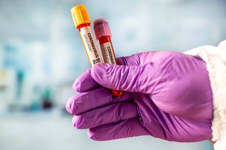 Nurse holds blood test tube for 2019 nCoV analysis. Coronavirus blood test concept.の写真素材