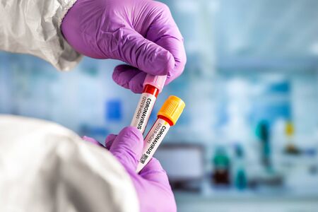 Nurse holds blood test tube for 2019 nCoV analysis. Coronavirus blood test concept.