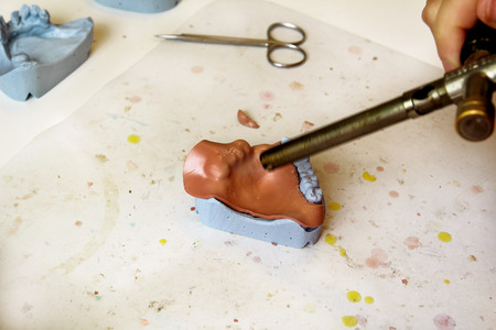 Warming of Shellac base plates. Dentures. Dental prosthesis, dentures, prosthetics work. Dental...