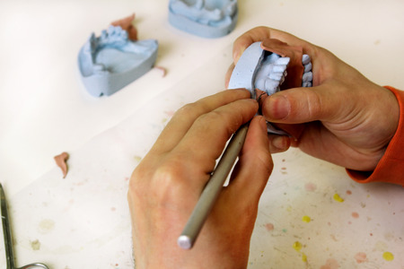 Trimming with scalpel Shellac base plates. Dentures. Dental prosthesis. Dental technician in process...
