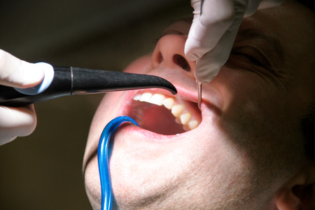 Dental tool for rinsing teeth. Teeth cleaning, dental hygiene. Dentist at work in his dentist clinic and office is rinsing of patient teeth with mirror, cleaning tool spray and suction tube in mouth.の写真素材
