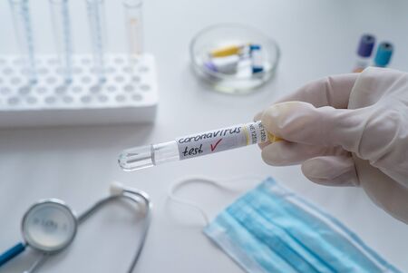 Doctor holds in his hands a positive blood test for a new rapidly spreading coronavirus