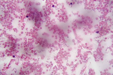 Microscope photo of human blood with Trypanosoma brucei a parasite responsible for African...