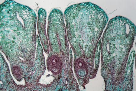 Detail of a female pine cone under the microscope.の写真素材