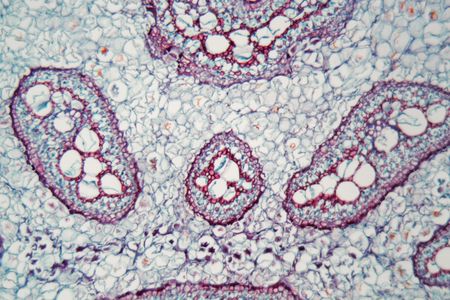 Section trough a fern stem under the microscope.