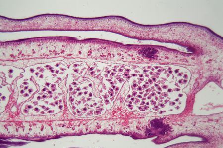 Segment of a tapeworm body (Proglottid) under the microscope.の写真素材