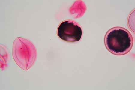 Eggs of a Taenia tapeworm. Taenia is a genus of tapeworm parasites on livestock and humans.の写真素材