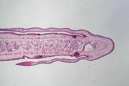Segment of a tapeworm body (Proglottid) under the microscope.