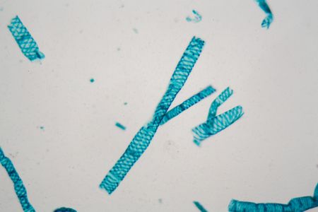 Filaments of Spirogyra alga under the microscope.の写真素材