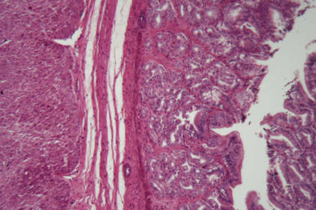 Microscope photo of a section through dog smooth muscle cells