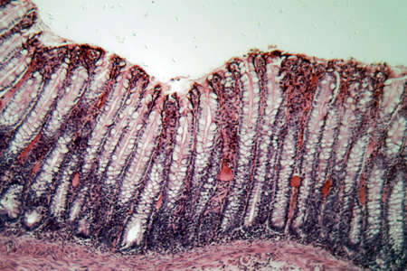 Microscope photo of a section through rectum cells of a dog.