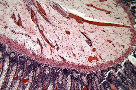 Microscope photo of a section through rectum cells of a dog.
