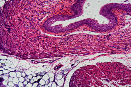 Cells of human transitional epithelium under the microscope.
