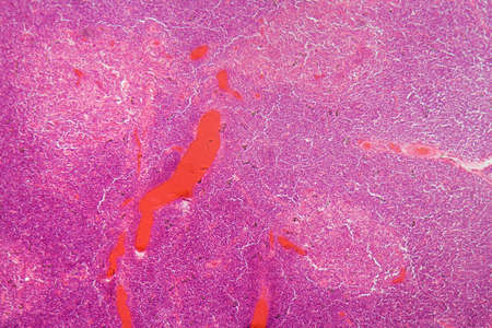 Cross section through cells of a human thymus gland under the microscope.