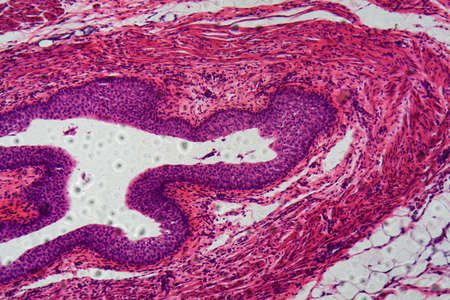 Cells of human transitional epithelium under the microscope.