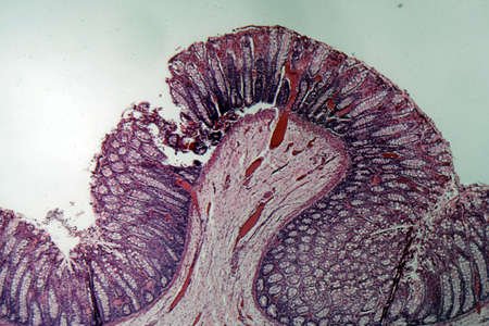 Microscope photo of a section through rectum cells of a dog.