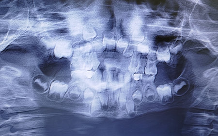 X-ray showing childs dental development