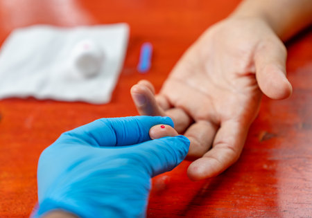 Red drop of blood on the finger, female hand, blood test.の写真素材