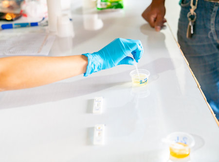 Urine test strips in blue gloves for screening.の写真素材