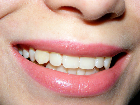 Photography with a scene of the feminine lips and teeth