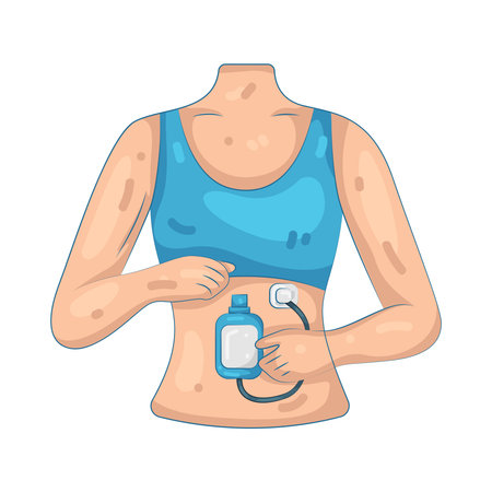 Girl Using Insulin Pumpのイラスト素材
