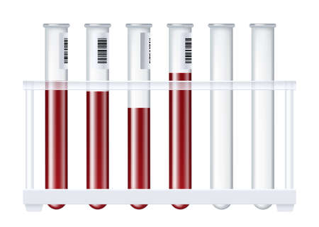 Blood bottle flasks plasma realistic test tube plastic or glass for science and dolld donationのイラスト素材