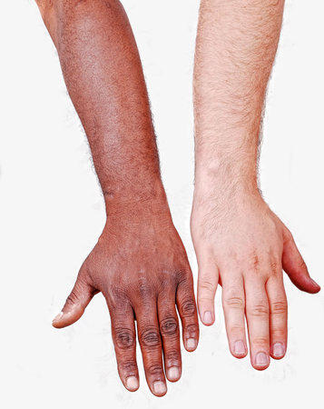 Comparable white hand and another black